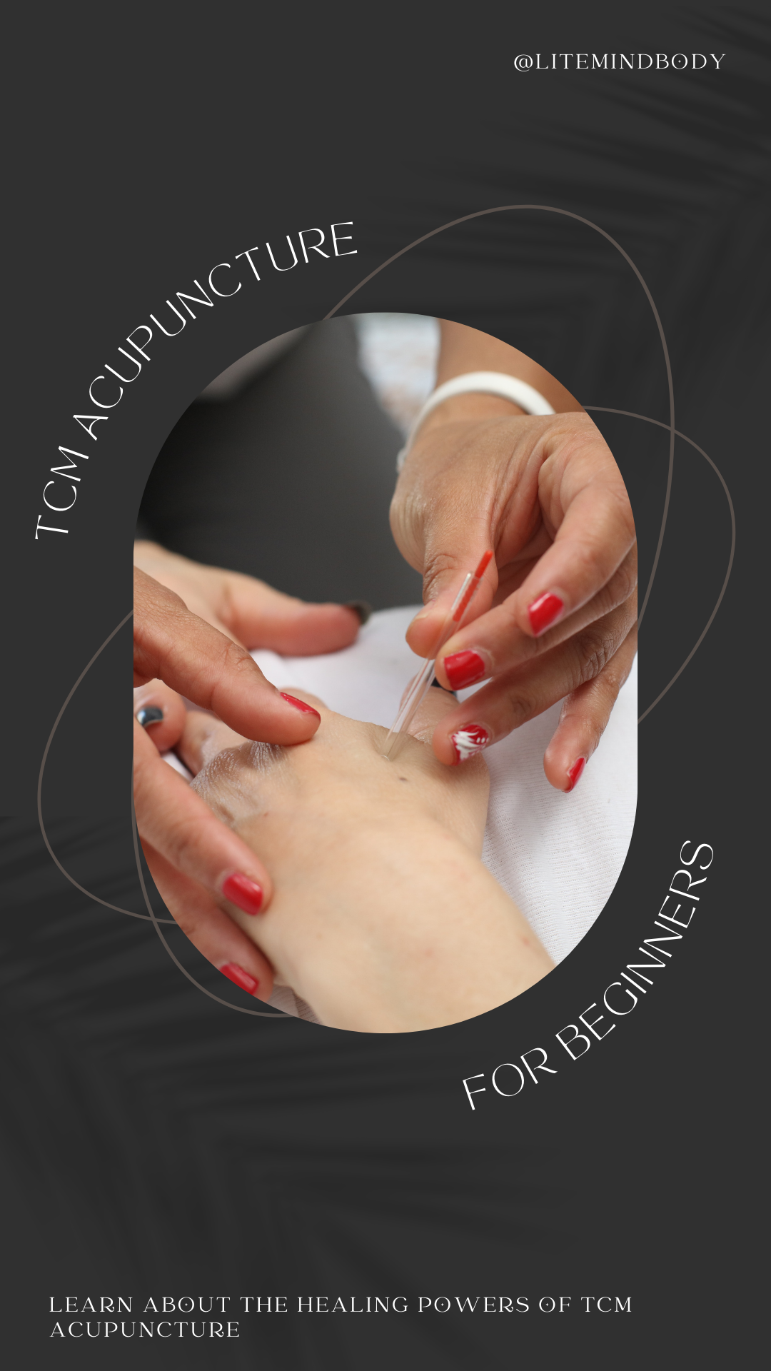TCM Acupuncture for Beginners