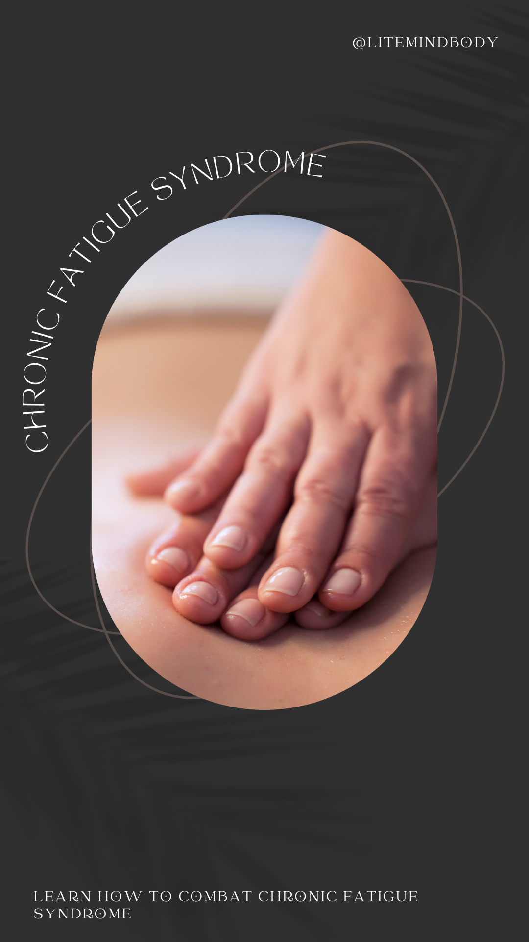 Chronic Fatigue Syndrome