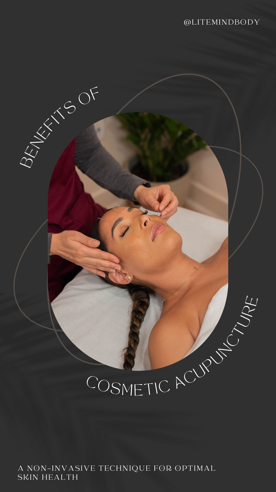 Why You Need to Try Cosmetic Acupuncture